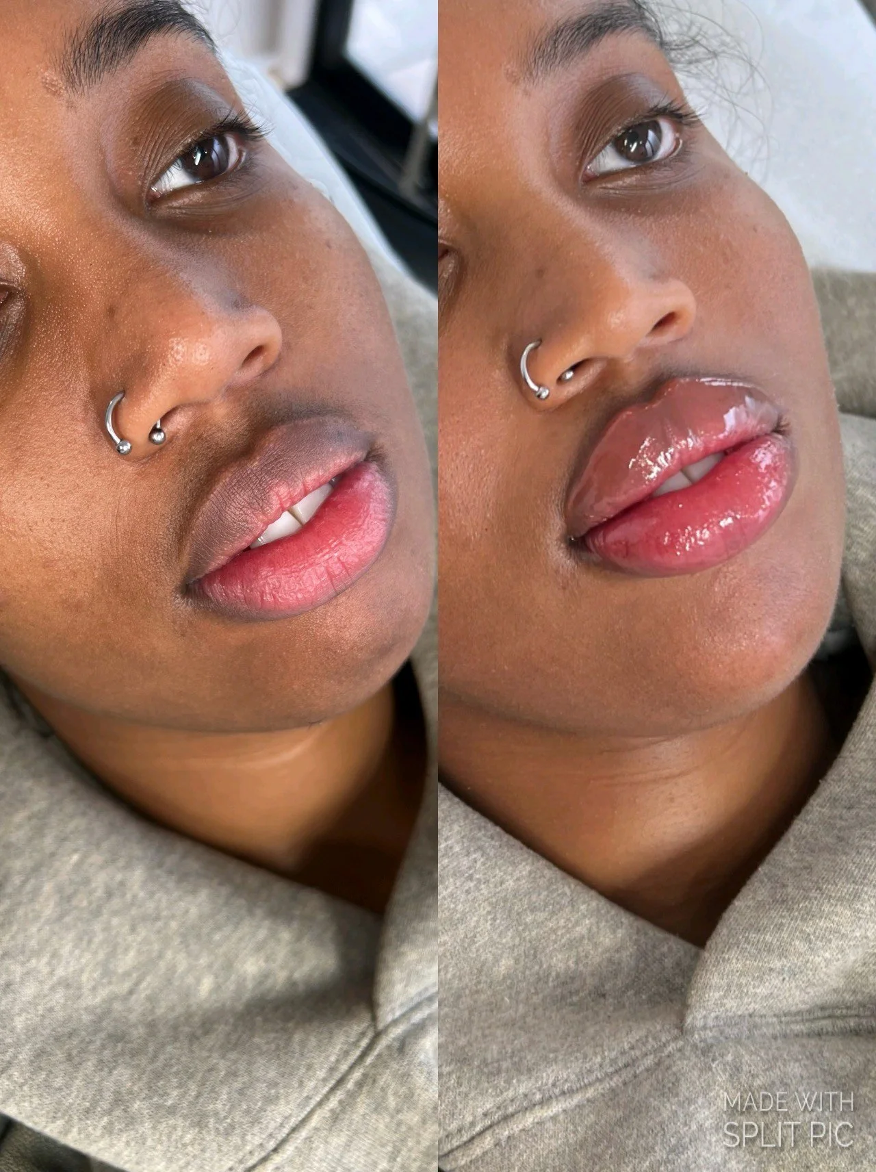 4ml Facial Balancing