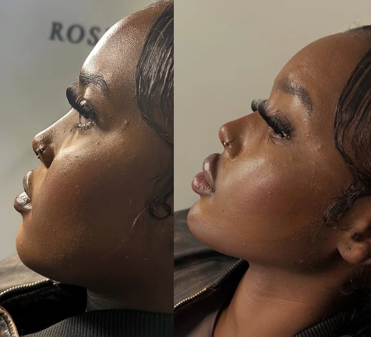 4ml Facial Balancing