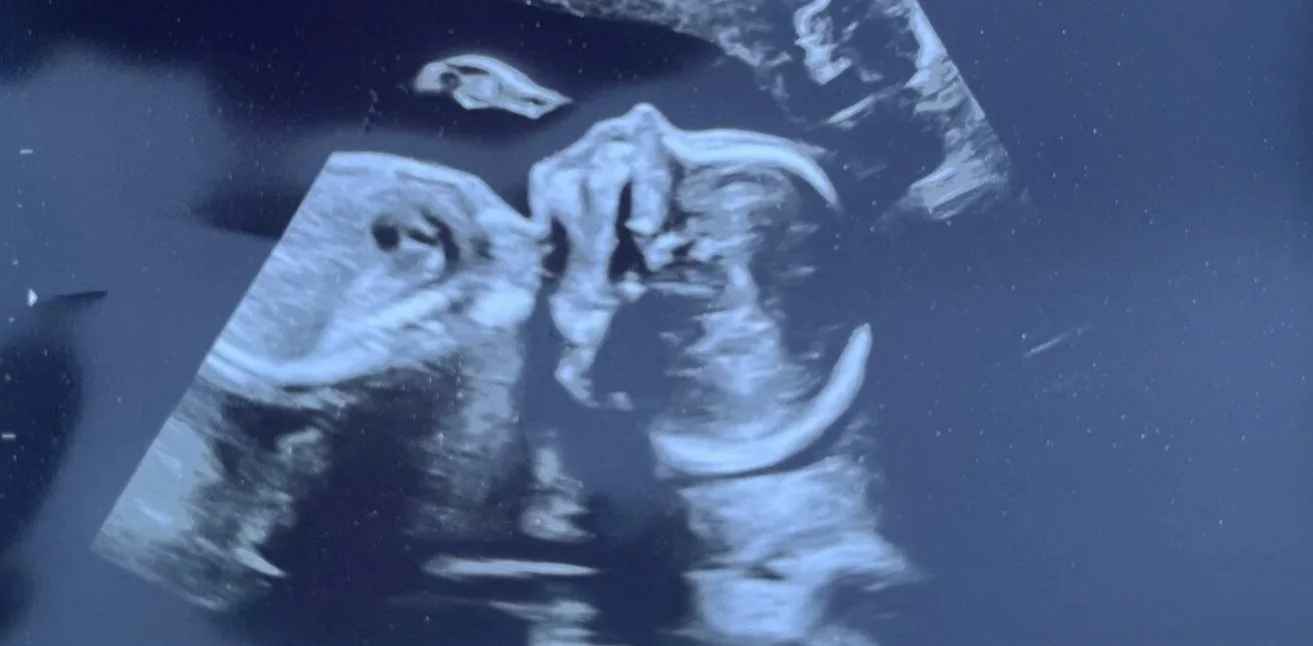 The Ultimate Guide to Prenatal Vitamins: Essential Nutrients Every Expecting Mama Needs!