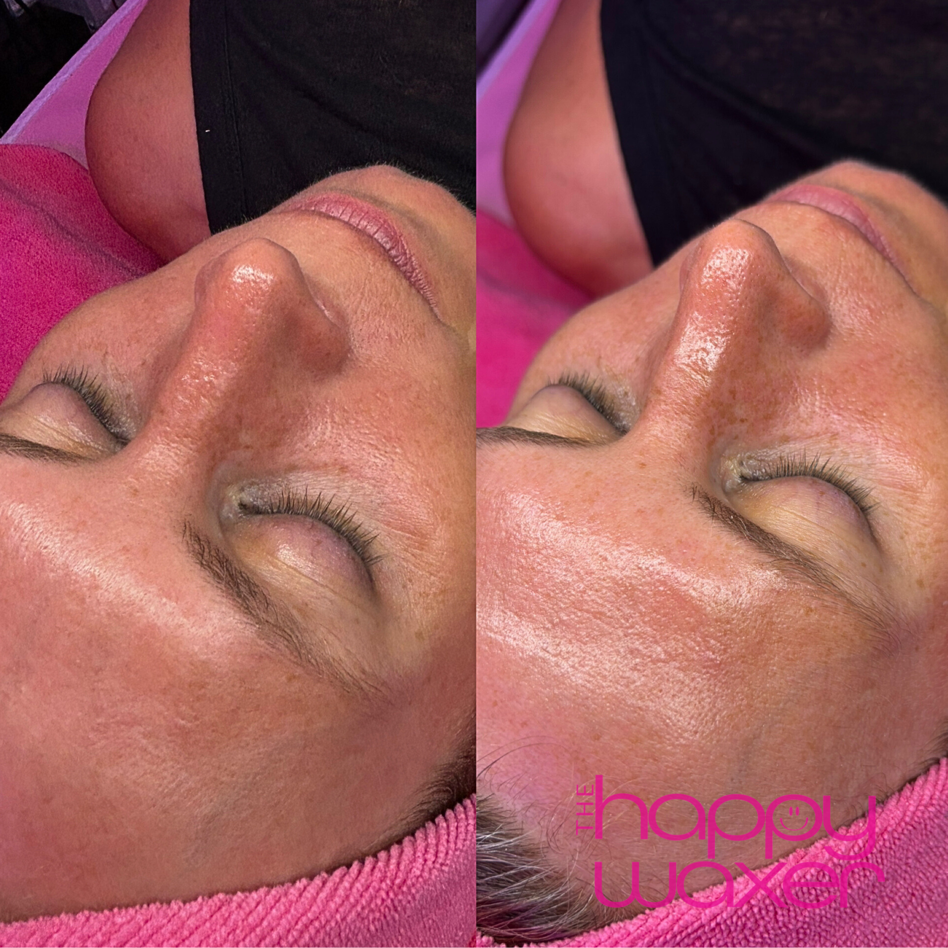 Glo2 BEFOREAFTER.png