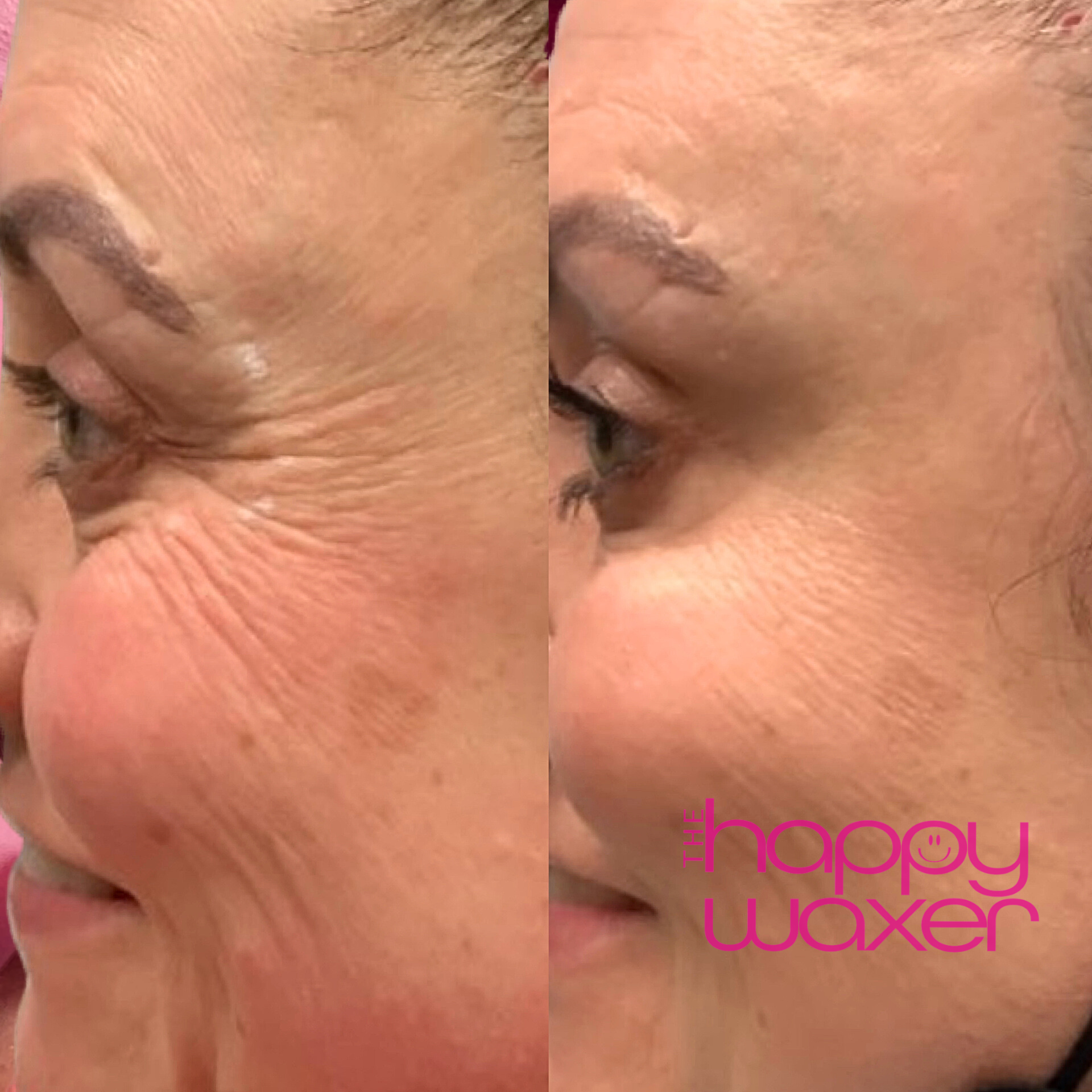 Crows before after.png