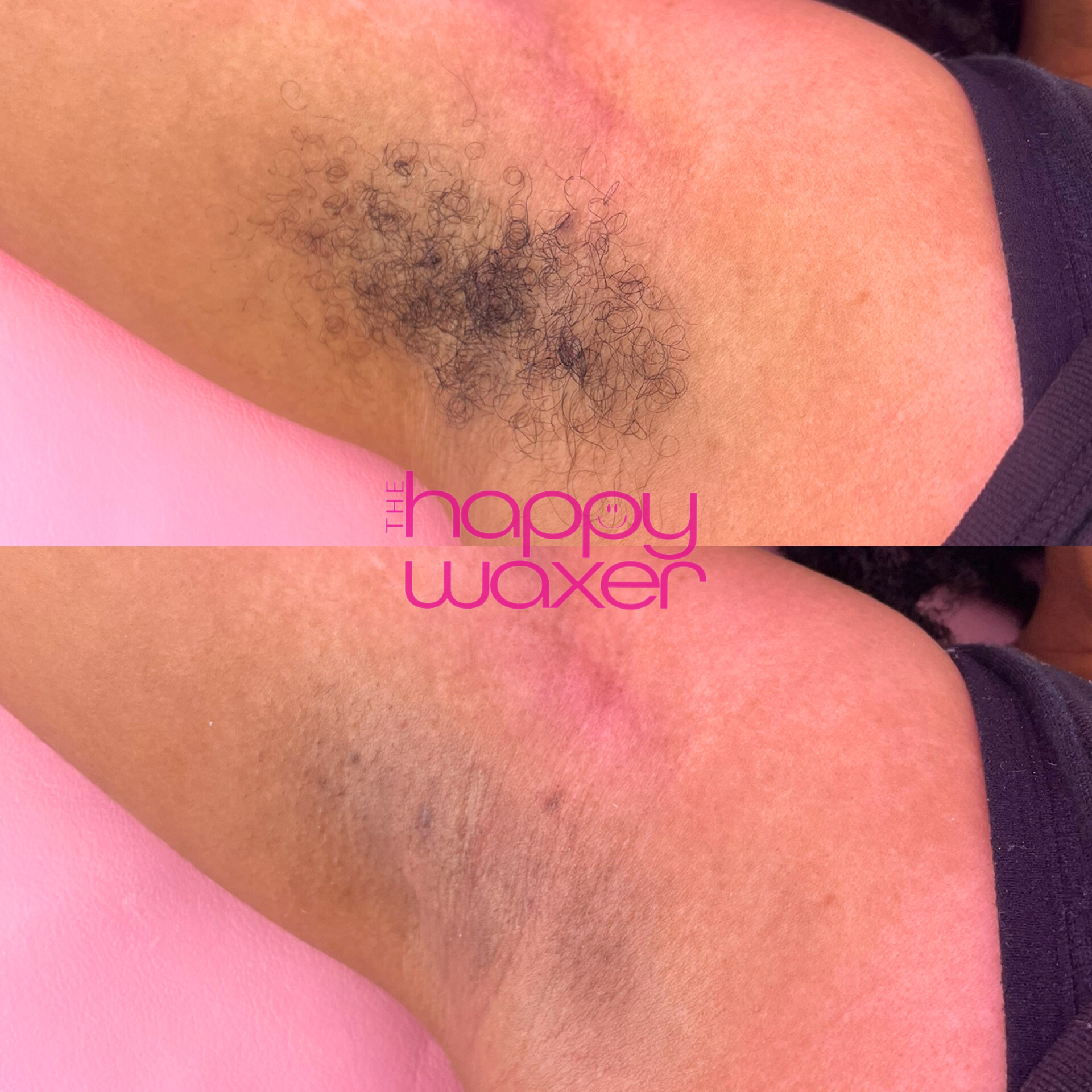 underarm before after.png