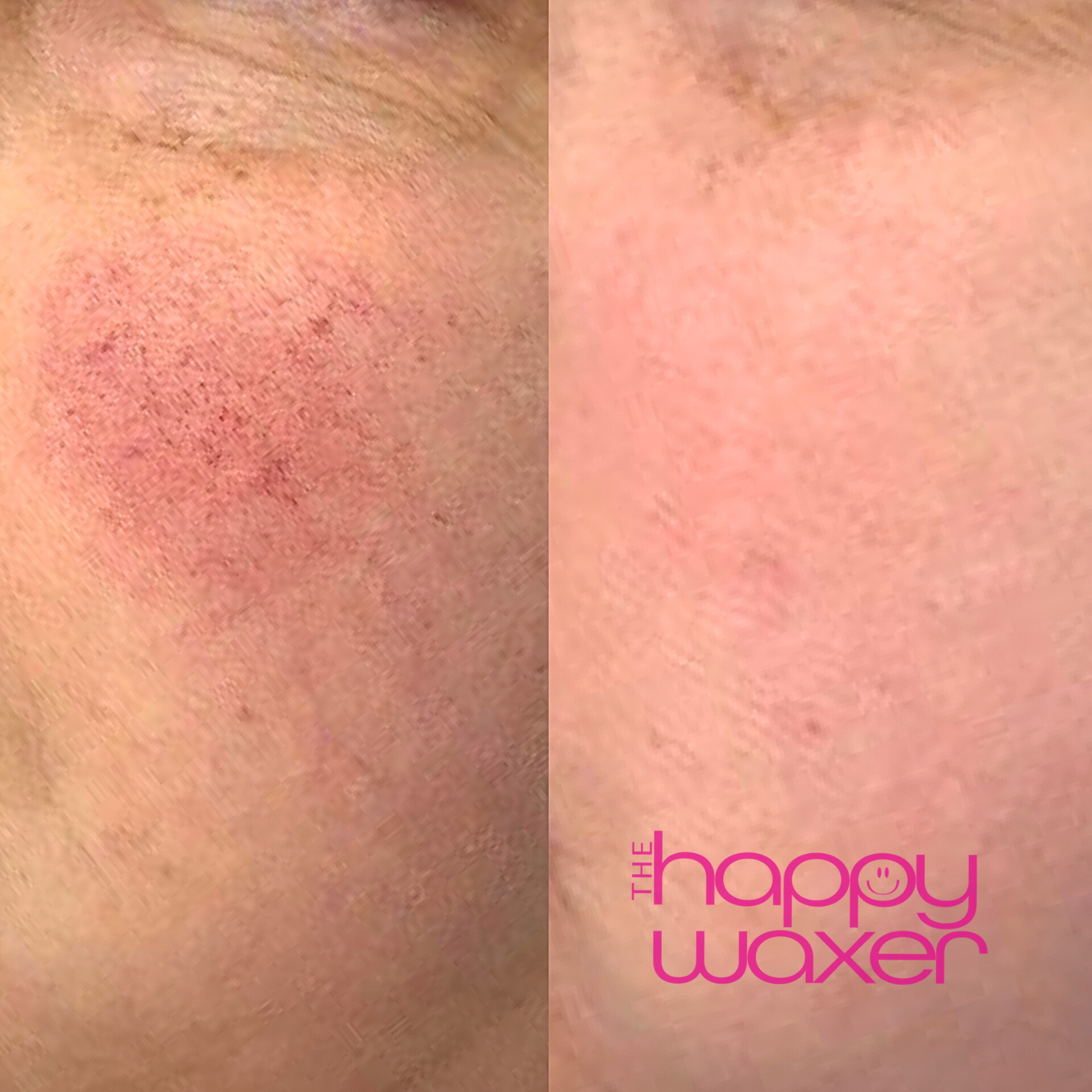 cheeks before after1.png