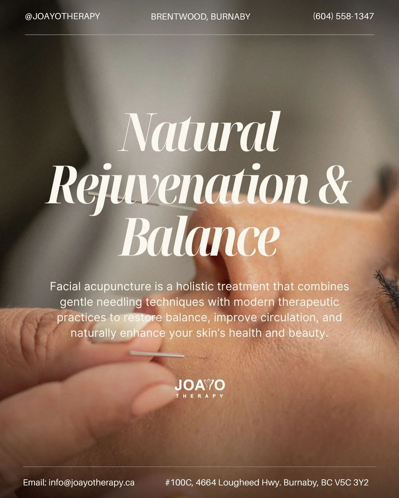 🌸 Facial Acupuncture: Natural Rejuvenation &amp; Balance 🌸

Facial acupuncture is more than a beauty treatment&mdash;it&rsquo;s a holistic approach to wellness. By blending the wisdom of Traditional Chinese Medicine with modern therapeutic techniqu