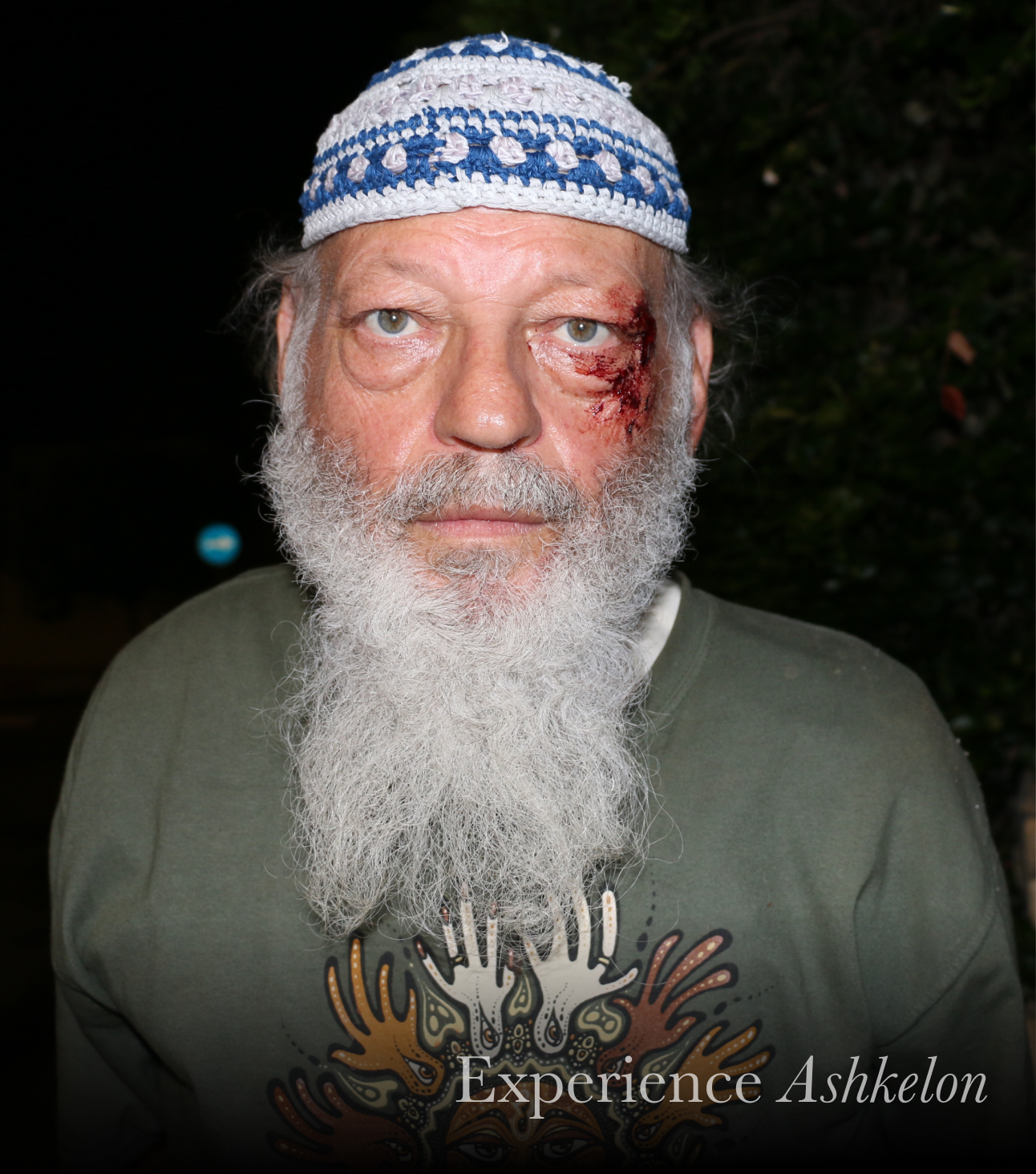 This man in southern Israel injured his eye while running into a house that was hit by a Hamas rocket.