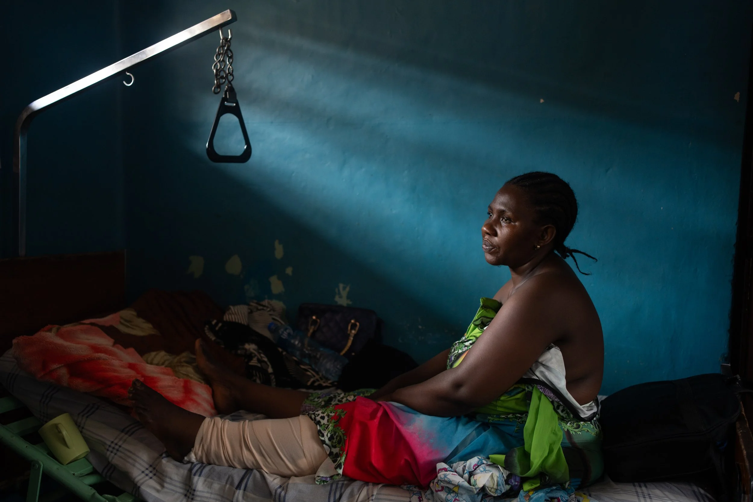 Anne-Marie, 41, was injured in Kavumu. "Point-blank, while a FARDC soldier tried to steal my phone, he shot me in the leg." Provincial General Hospital of Bukavu. DRC, February 18, 2025.