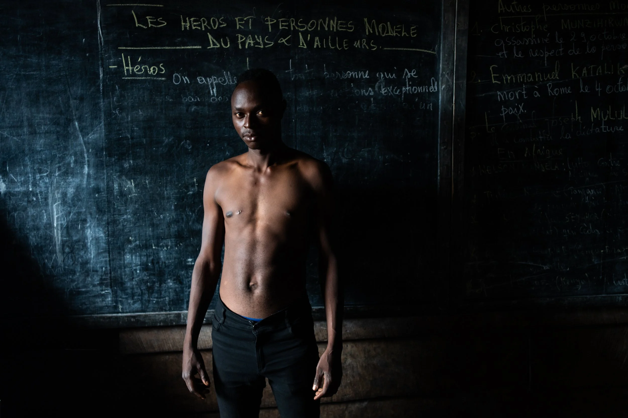 Patrick, 26, was displaced due to the clashes between M23 and the FARDC. "I was hit by a stray bullet in the chest. I don’t really know why there’s a war, but it’s not over."
DRC, February 8, 2025.