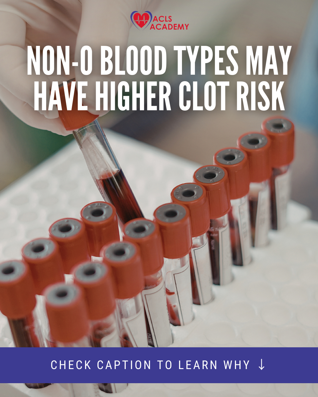 Does Your Blood Type Influence Your Heart Health? What the Latest Research Shows