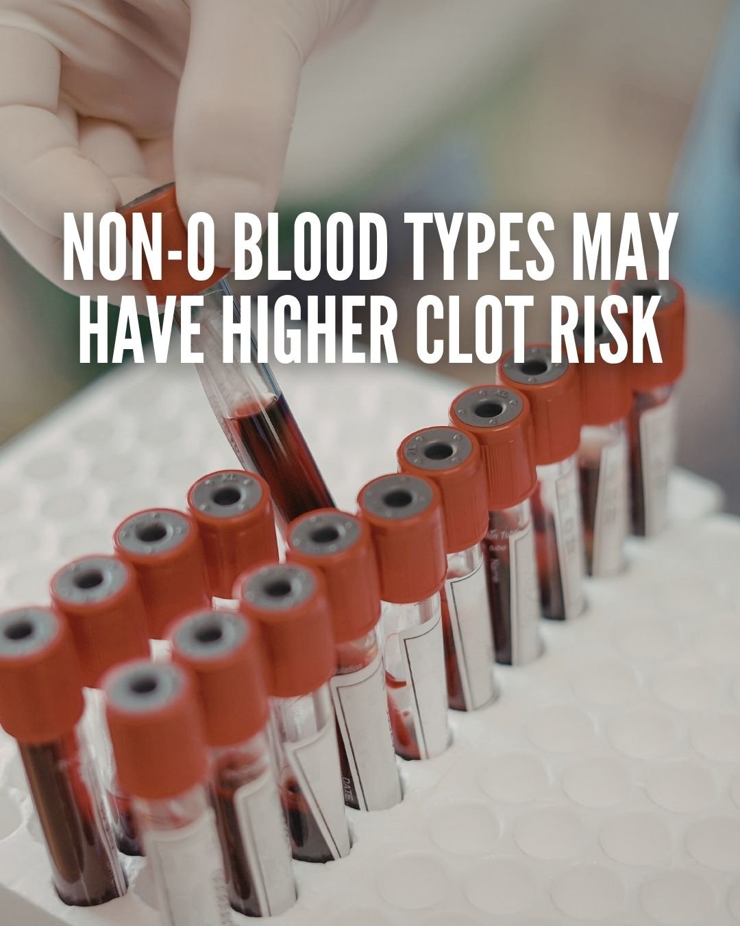 Does Your Blood Type Influence Your Heart Health? What the Latest Research Shows