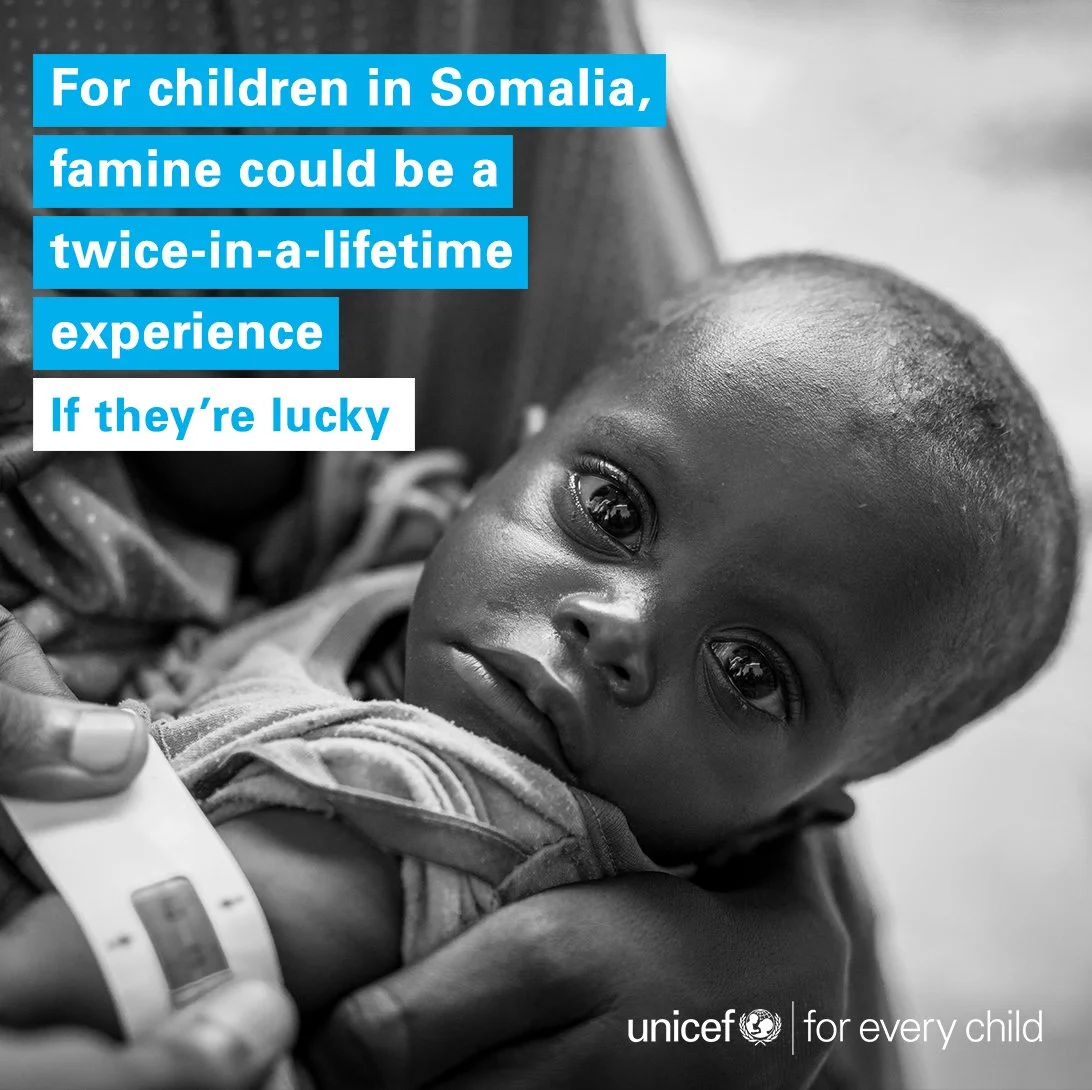 Malnourished infant being measured in Somalia, UNICEF famine awareness campaign created by STORO