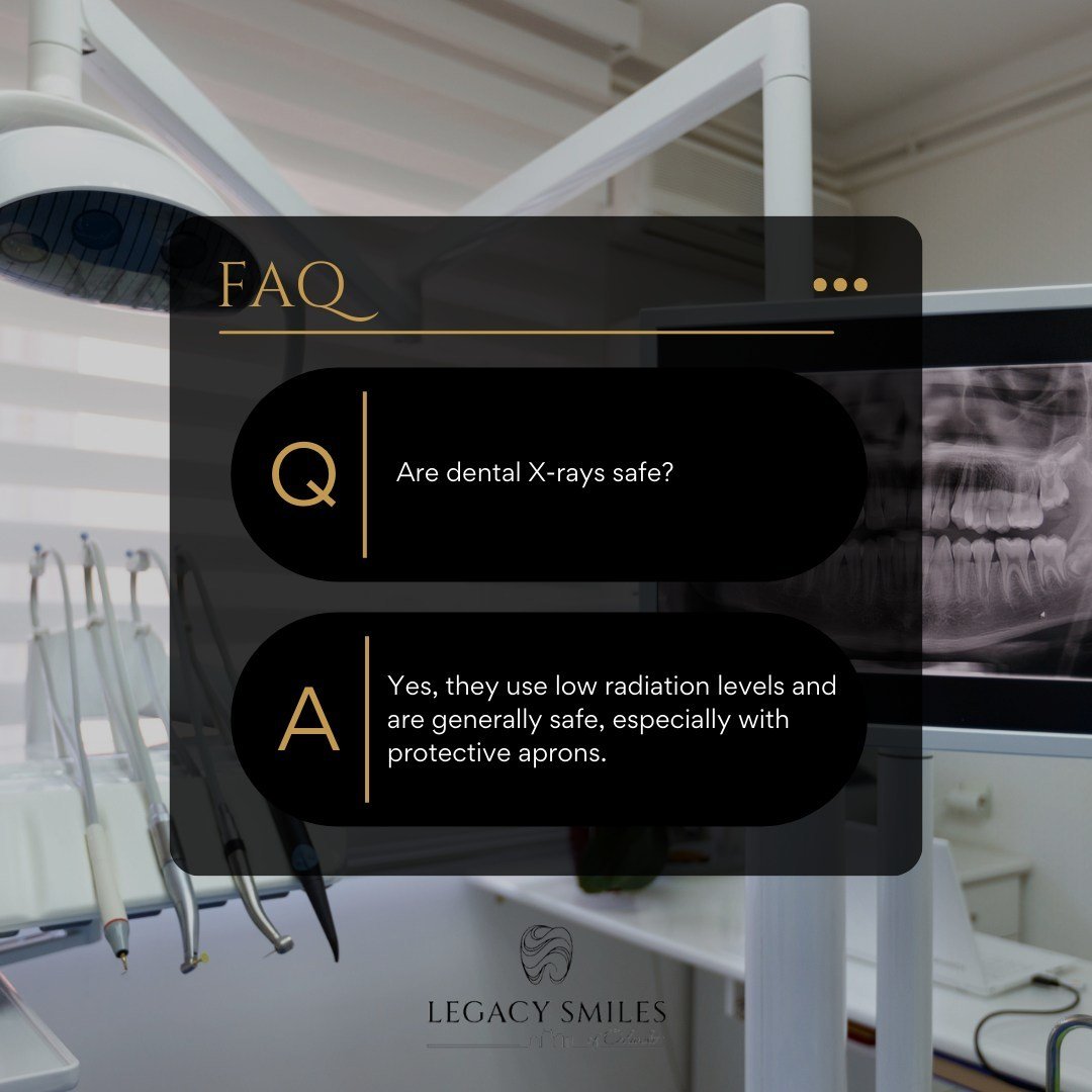 Rest assured, dental X-rays are safe and play a crucial role in preventive care. 🌟 We use advanced technology to keep radiation exposure minimal while helping us catch issues early for a healthier smile.

#LegacySmilesofOrlando #OrlandoDentist #Safe