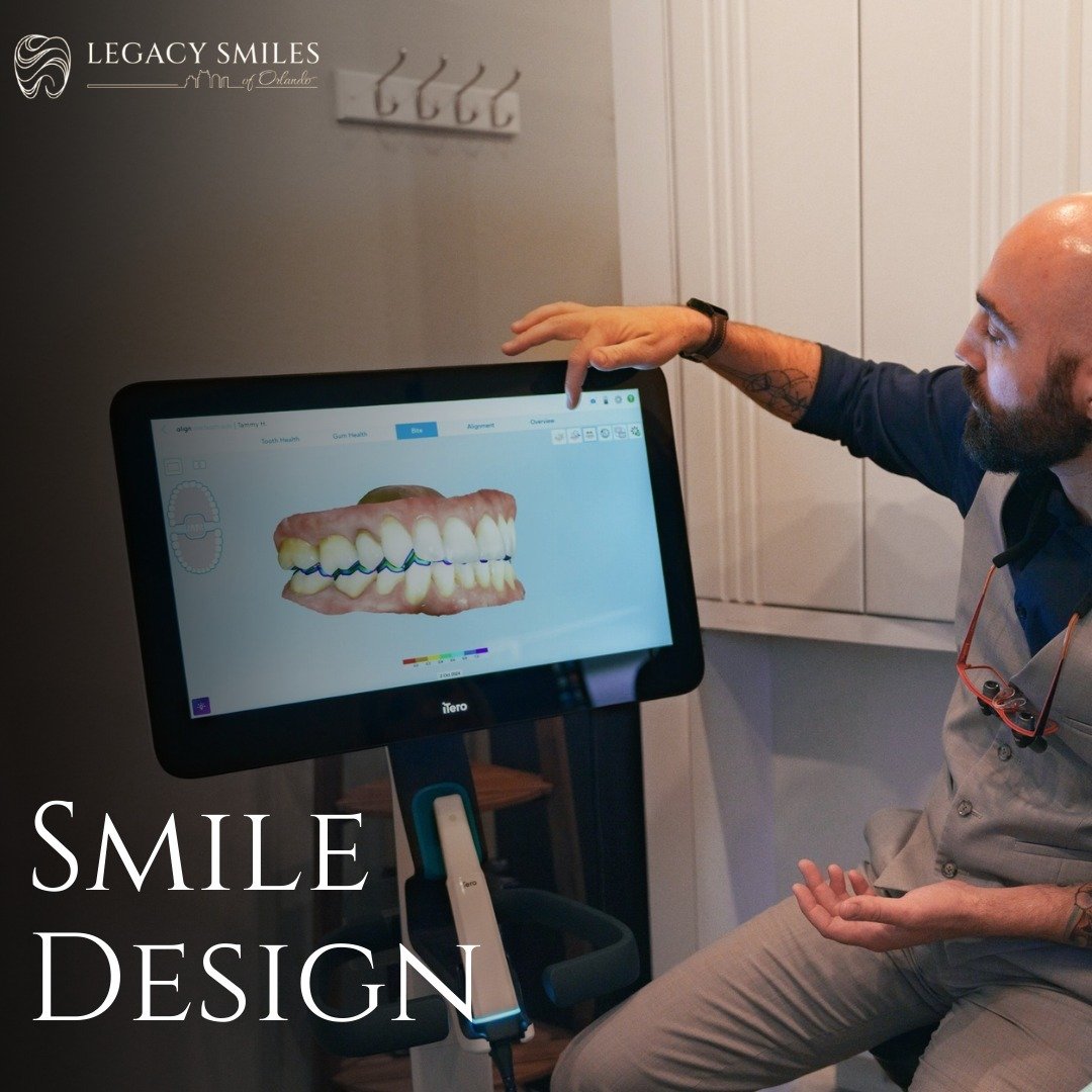 Your dream smile is within reach! Our smile design services customize your treatment to achieve the look you want, with the care and precision you deserve. 😊 Let&rsquo;s create a smile that brings out the best in you!

#LegacySmilesofOrlando #Orland