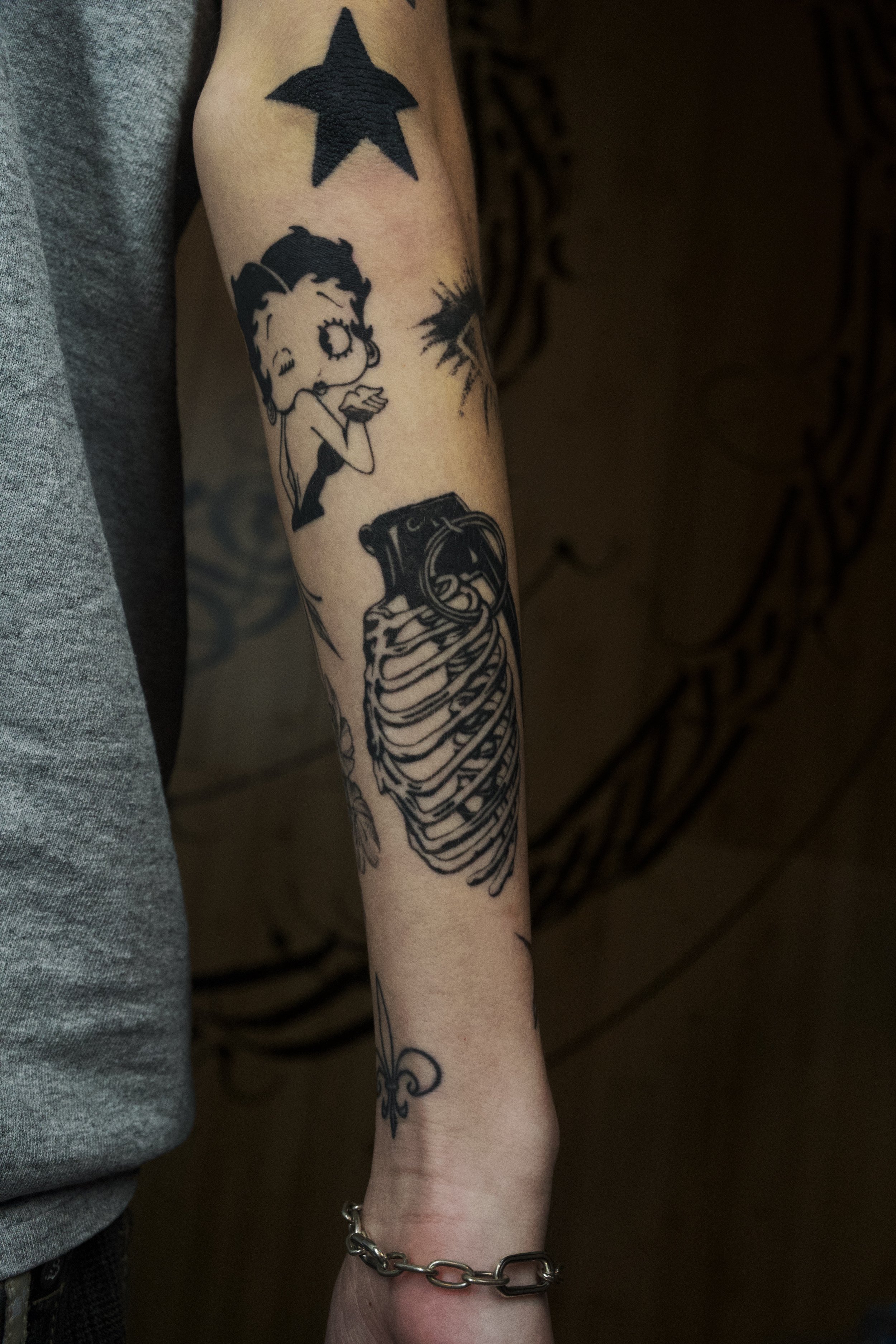 Ribcage Grenade - 2 Months Healed