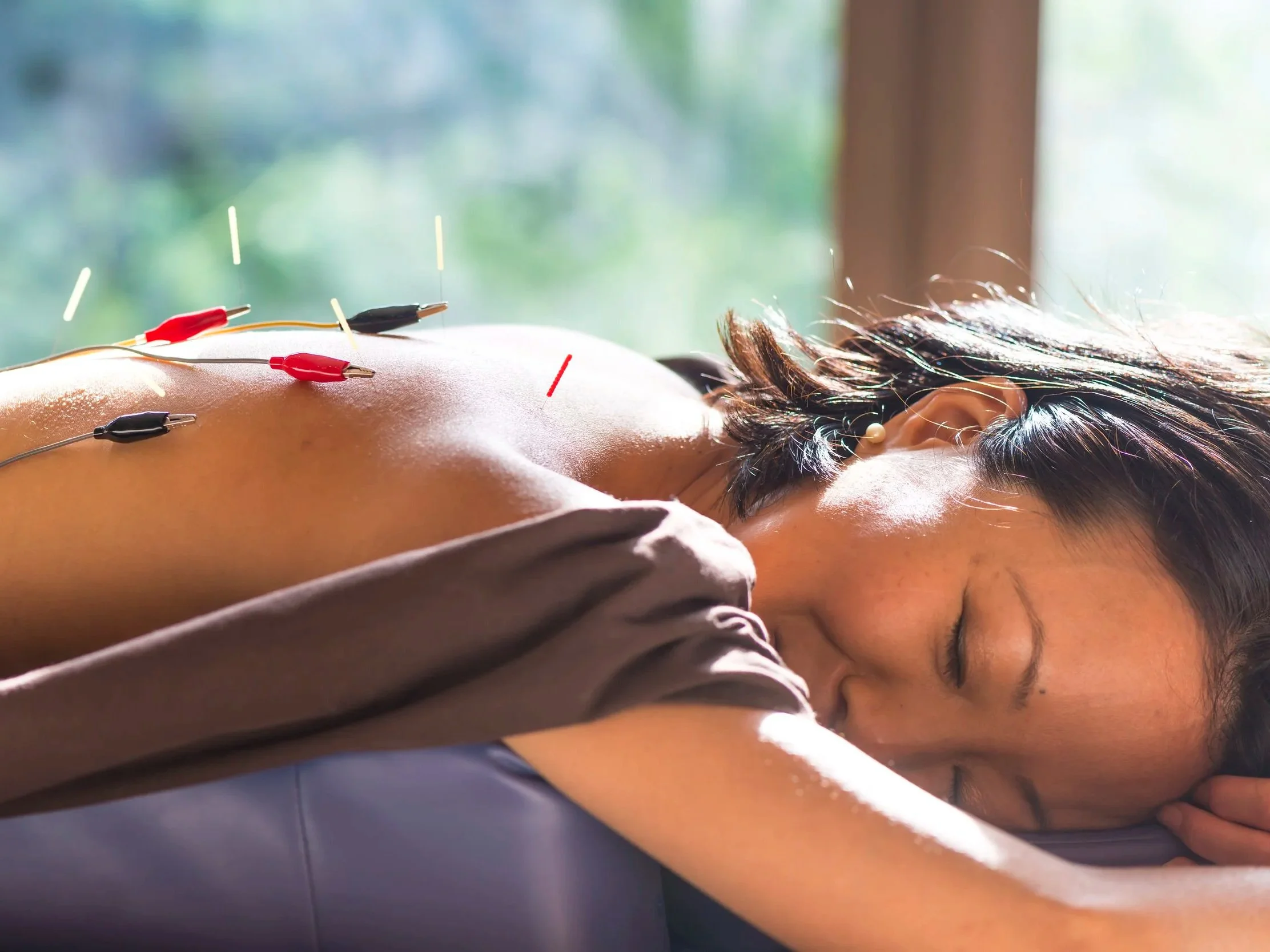 Acupuncture and the Menopause Transition