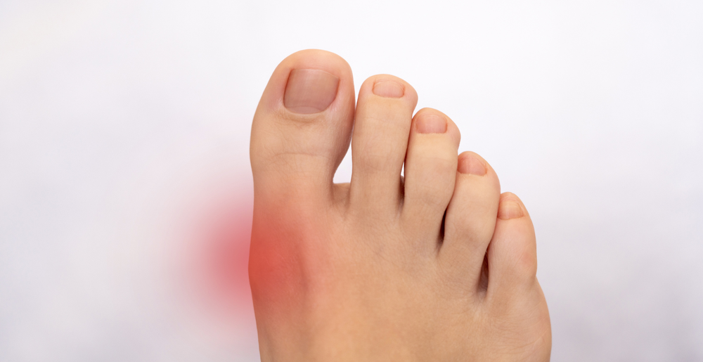 Big Toe Joint Pain Relief | The Hills Foot Clinic Sydney — The Hills ...