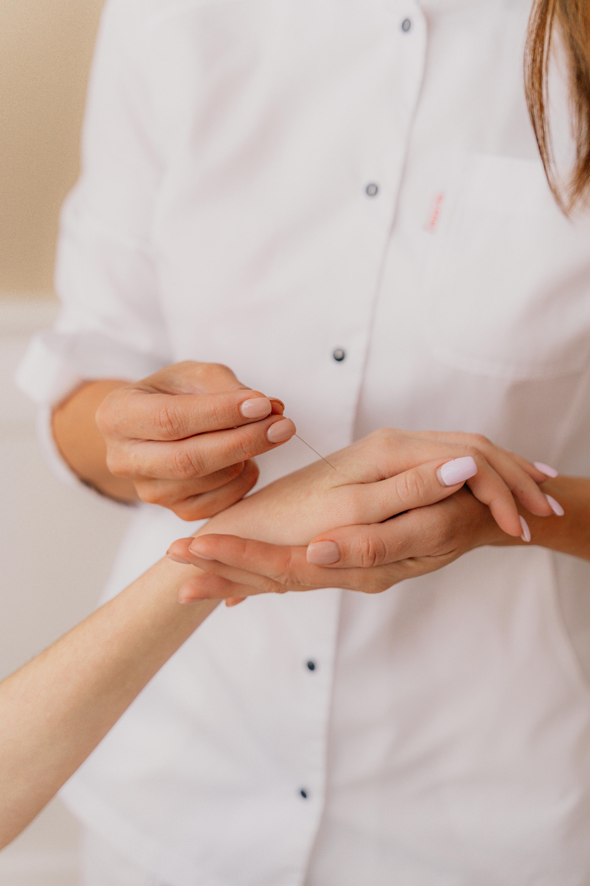 How Acupuncture can help you