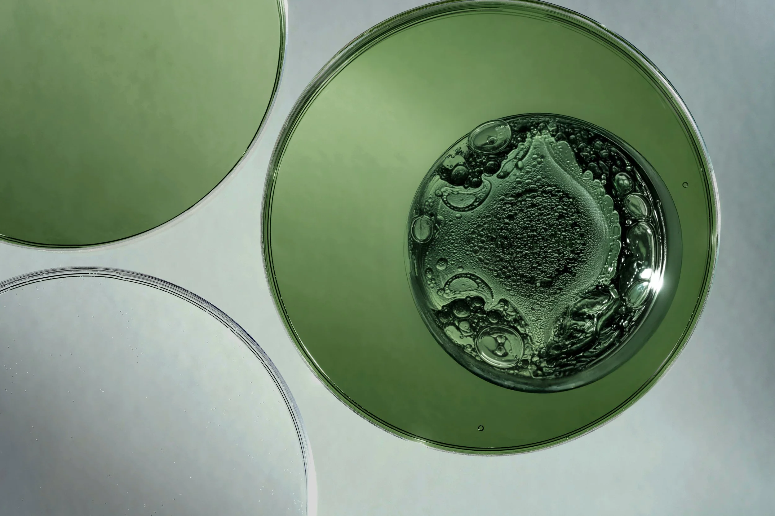 exosome-skin-needling-melbourne