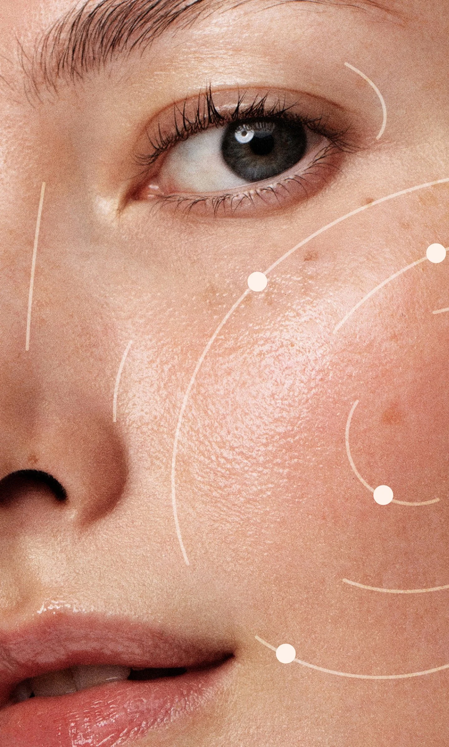 EXOSOME SKIN NEEDLING ARMADALE VIC