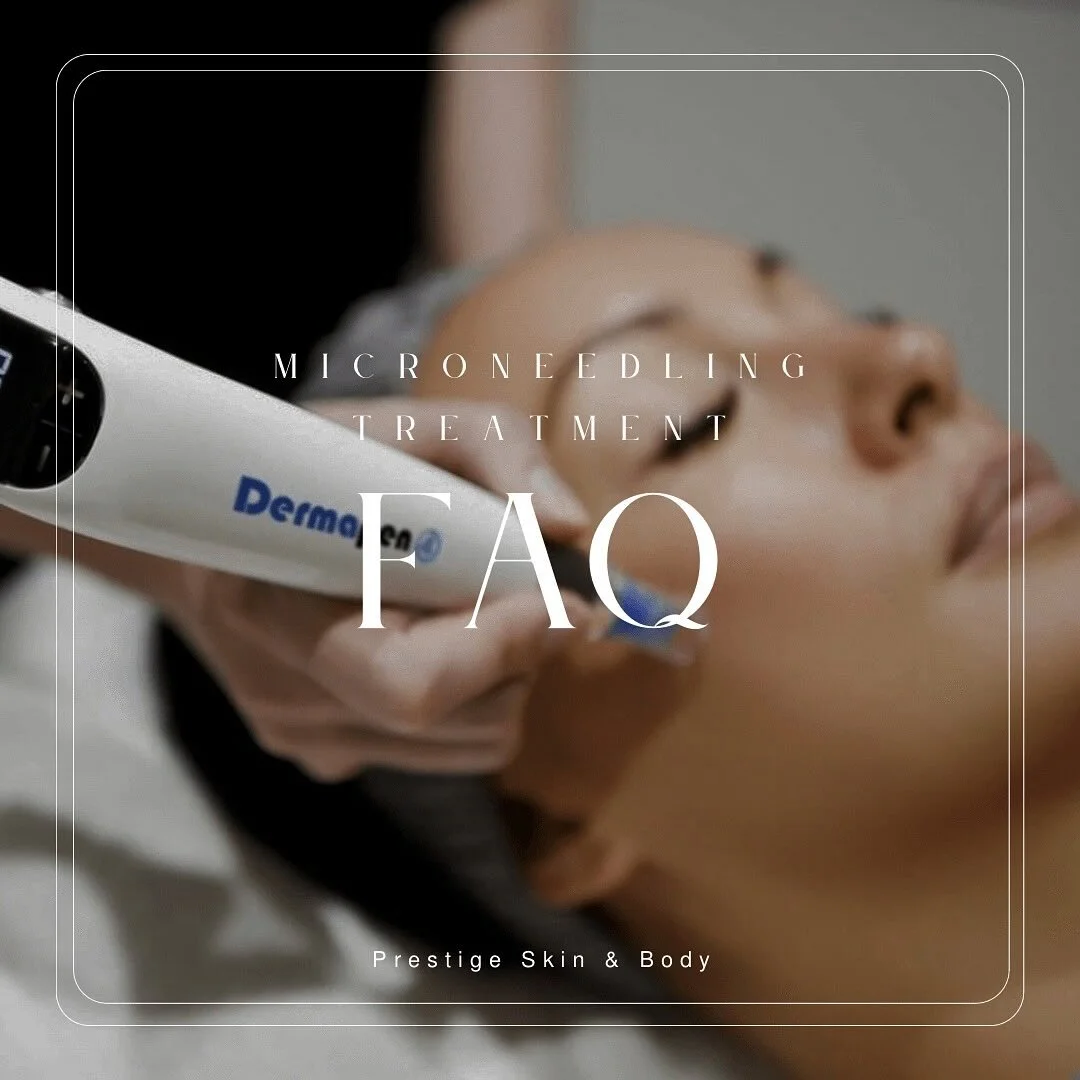 Microneedling FAQ ✨
.
.
.
Does it hurt? 👇🏼
- Microneedling feels like a light prickly sensation and most clients describe it as mild and very tolerable. 

How many sessions are needed? 👇🏼
- For best results, we usually recommend a course of 3-6 s
