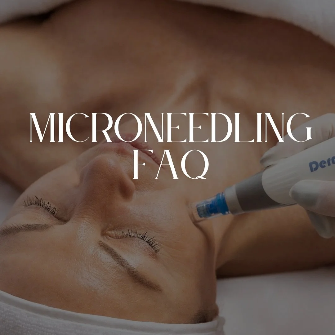 FAQ ✅
.
.
.
.

Q: Does microneedling hurt?

A: Most clients describe it as mild discomfort rather than pain. We keep you as comfortable as possible and the session is quick and tolerable 🤍
.
.
.

After treatment, you can expect some redness (like a 