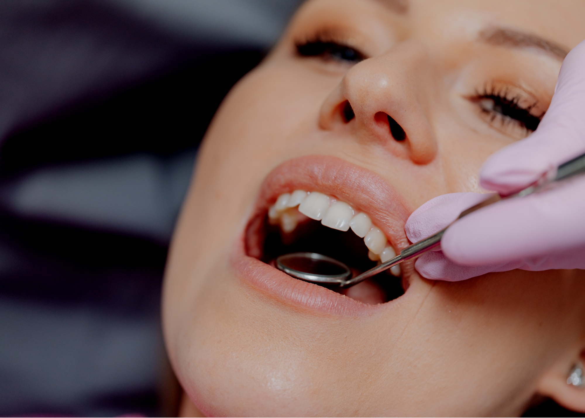 Close-up of a woman receiving a dental check-up, with a dental mirror near her teeth.