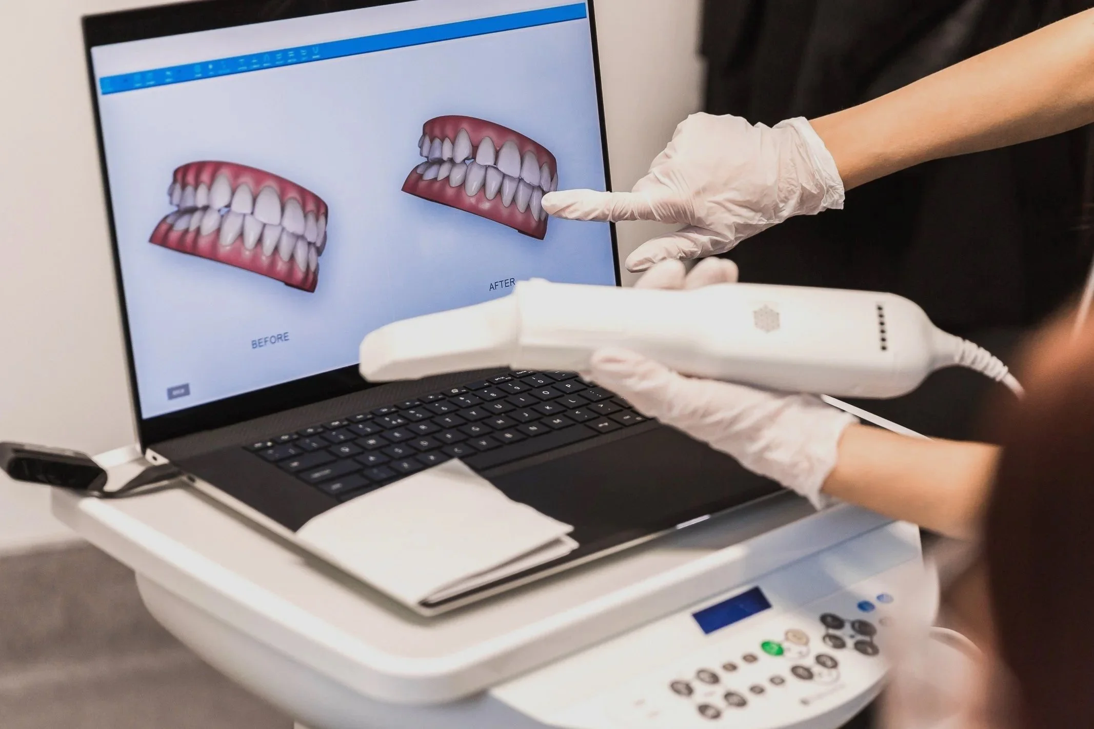 Person viewing 3D digital dental model on computer screen, holding scanner.