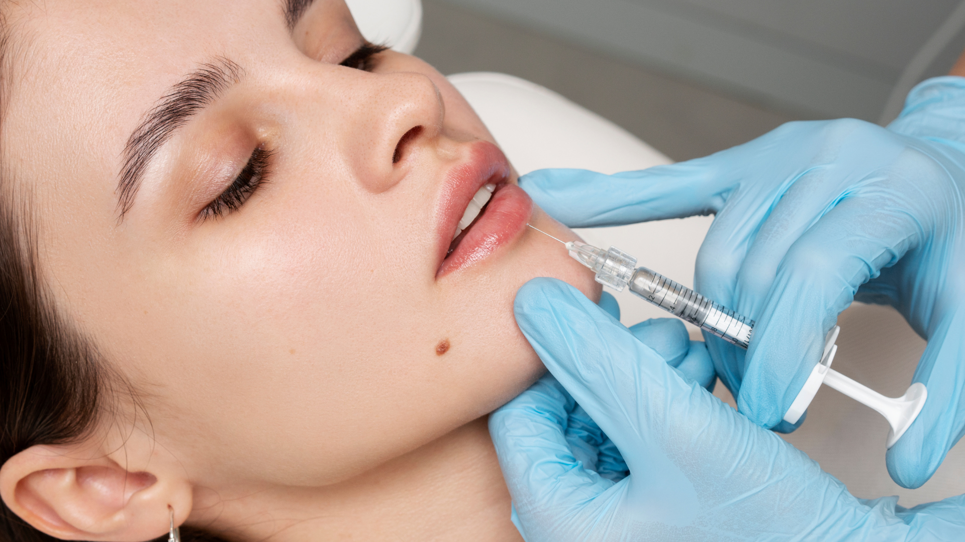 Lip Filler.png