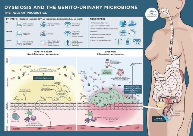 Dysbiosis and the Female Genito-Urinary Microbiome Infographic