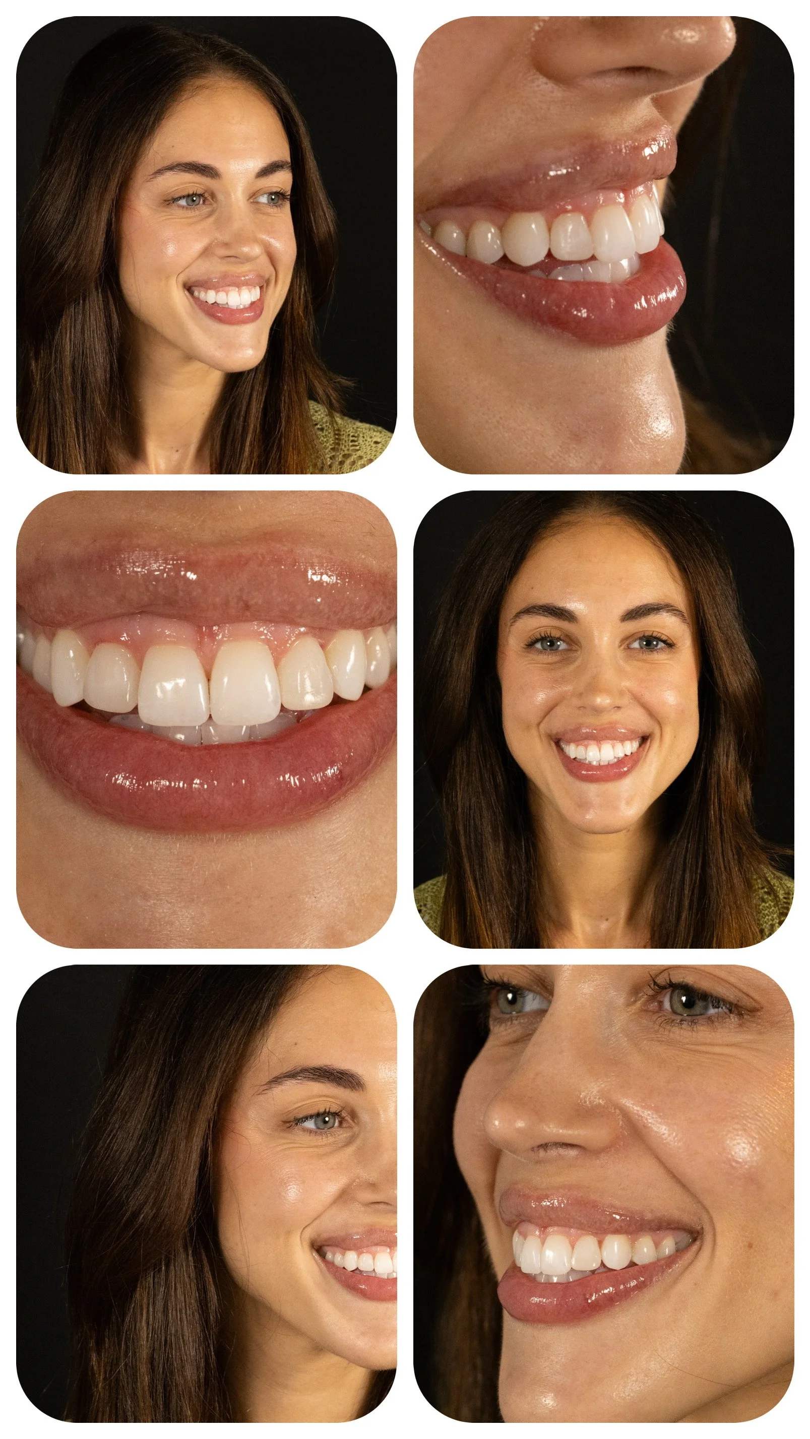 E is for Esthetics