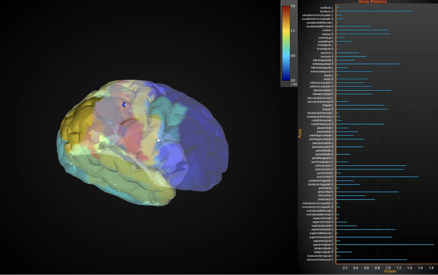 What is Neurotherapy and Brain Mapping?