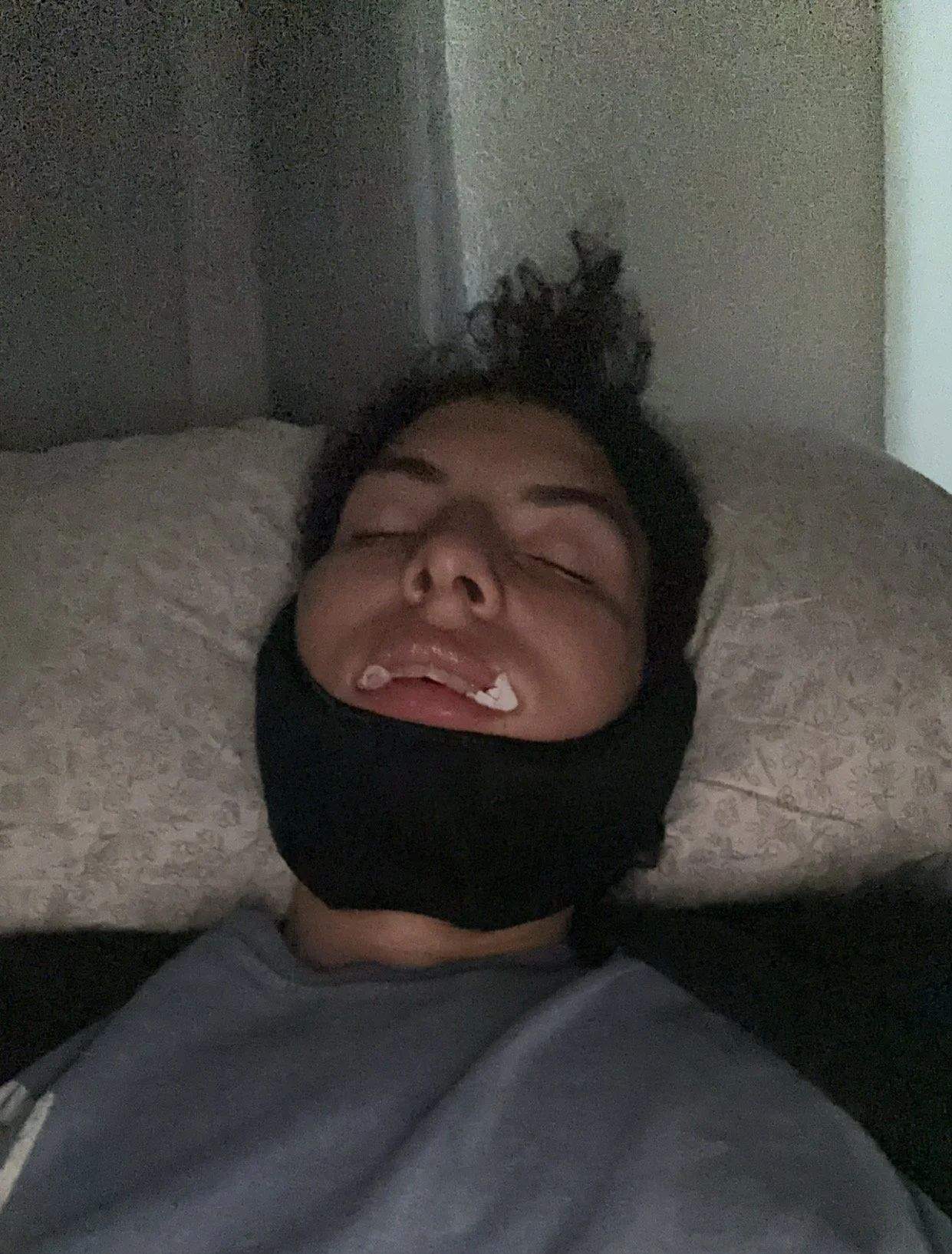 wisdom teeth removal recovery • my herbal healing protocol