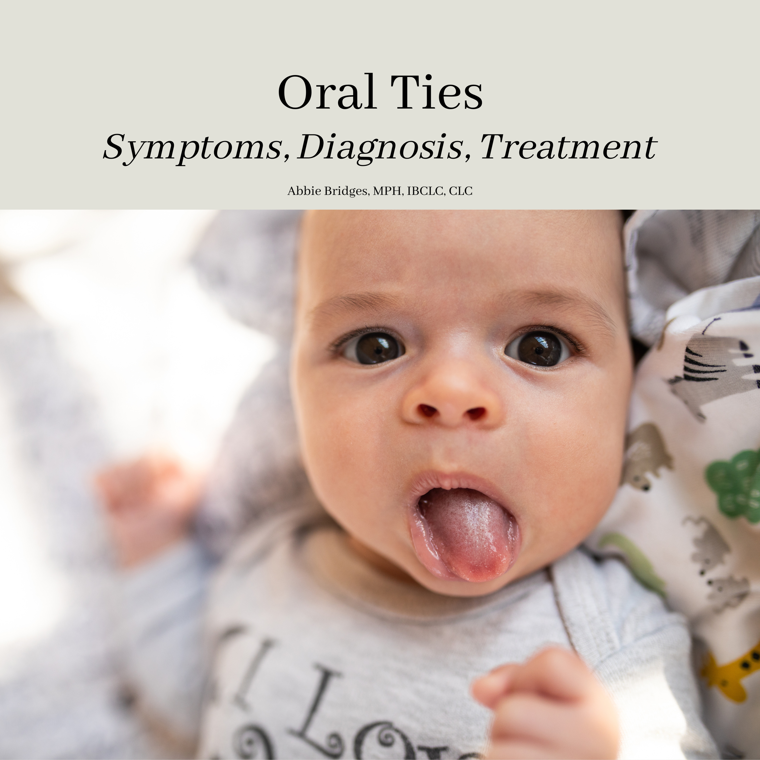 Oral Ties: Symptoms, Diagnosis, Treatment