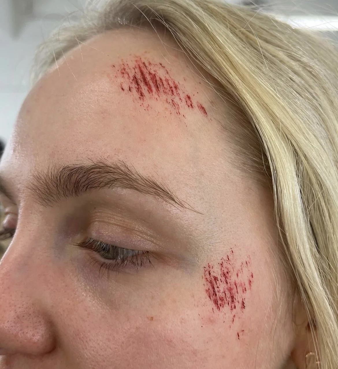 SFX Abrasions
