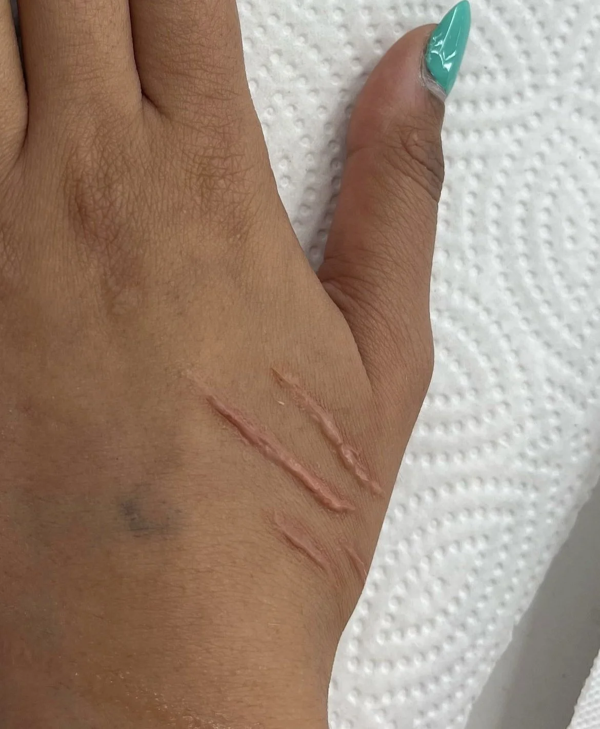SFX Scarring