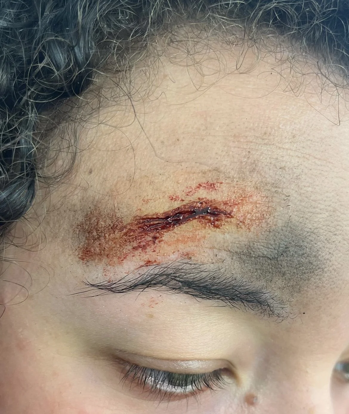 SFX Bondo Transfer Wound