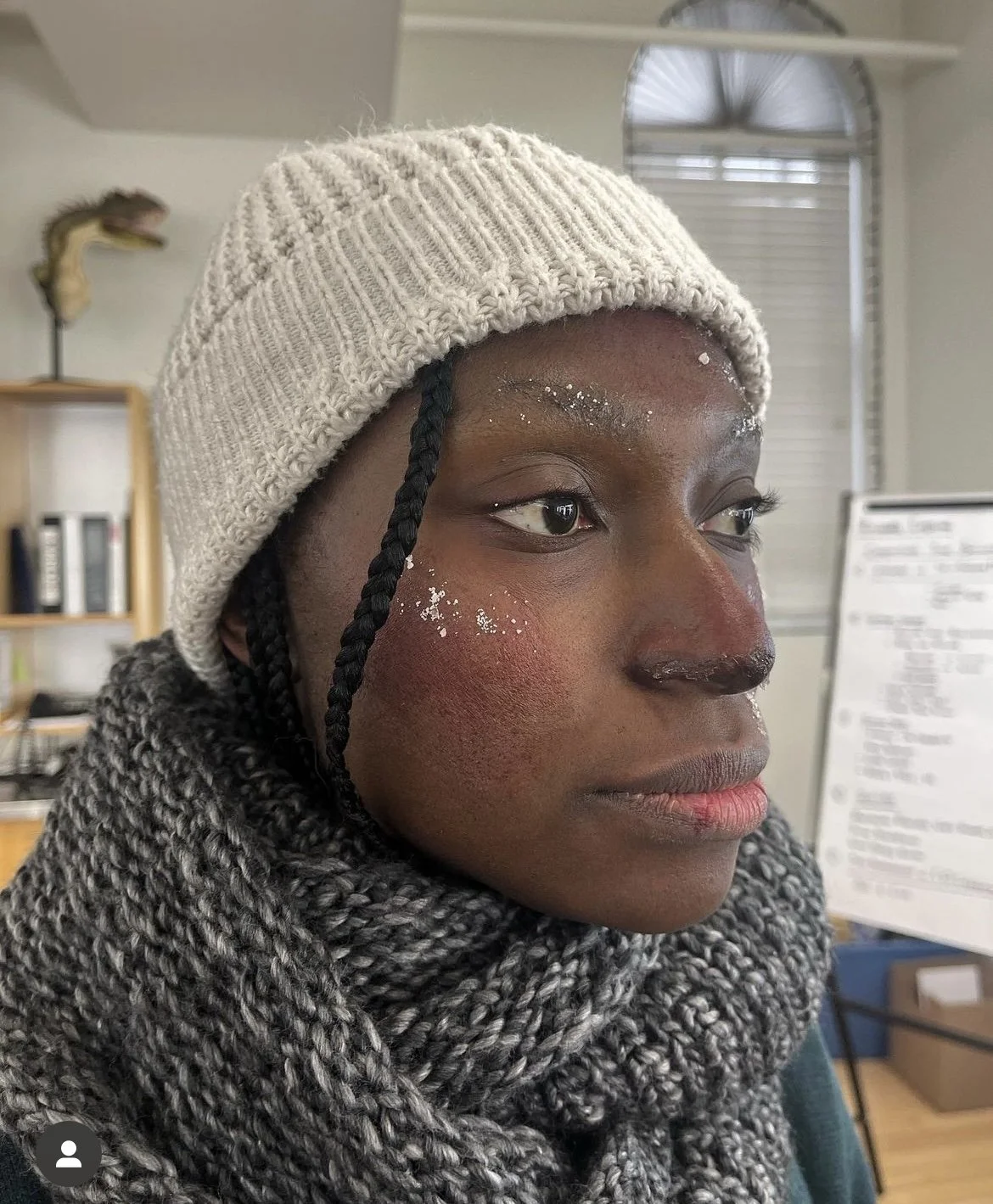 SFX Frostbite
