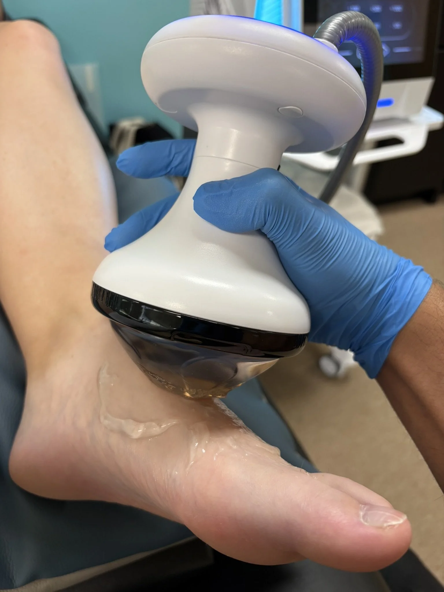 Shockwave therapy device used to treat acute and chronic injuries including tendon, ligament, bone, and muscle injuries without surgery.