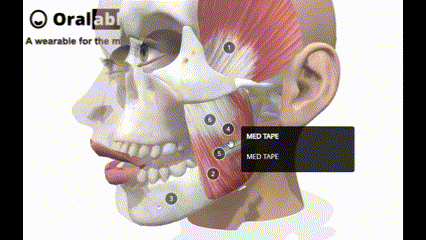 Oralable