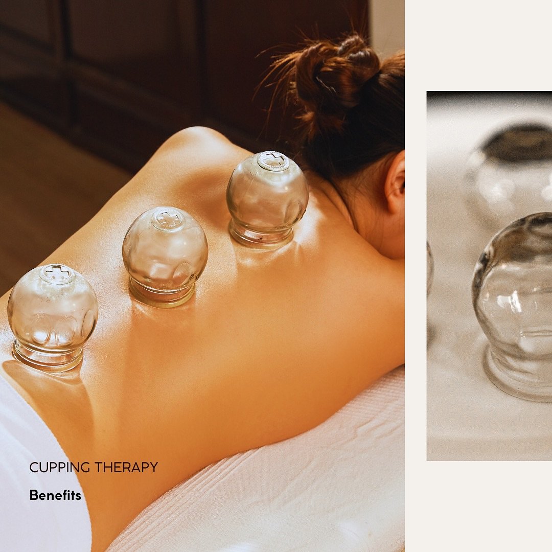 Now Offering: Cupping Therapy at St. John Club💫

Ready to take your wellness to the next level?&nbsp;&nbsp;Rooted in ancient Asian medicine, particularly Traditional Chinese Medicine, Cupping therapy has been used for thousands of years to promote h