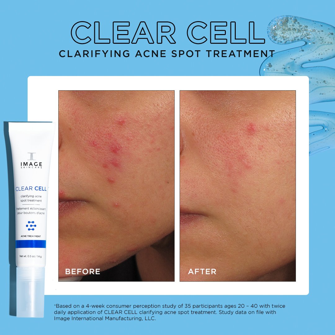 CLEAR-CELL-CLARIFYING-ACNE-SPOT-TREATMENT-PDP-R08.jpg