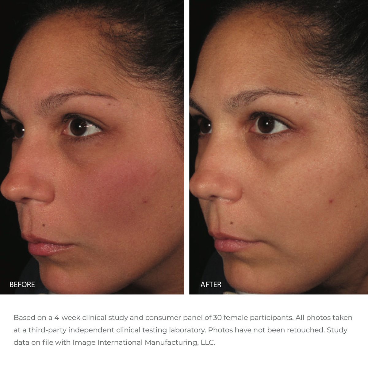 ORMEDIC_balancing_antioxidant_serum_PDP_R02.jpg