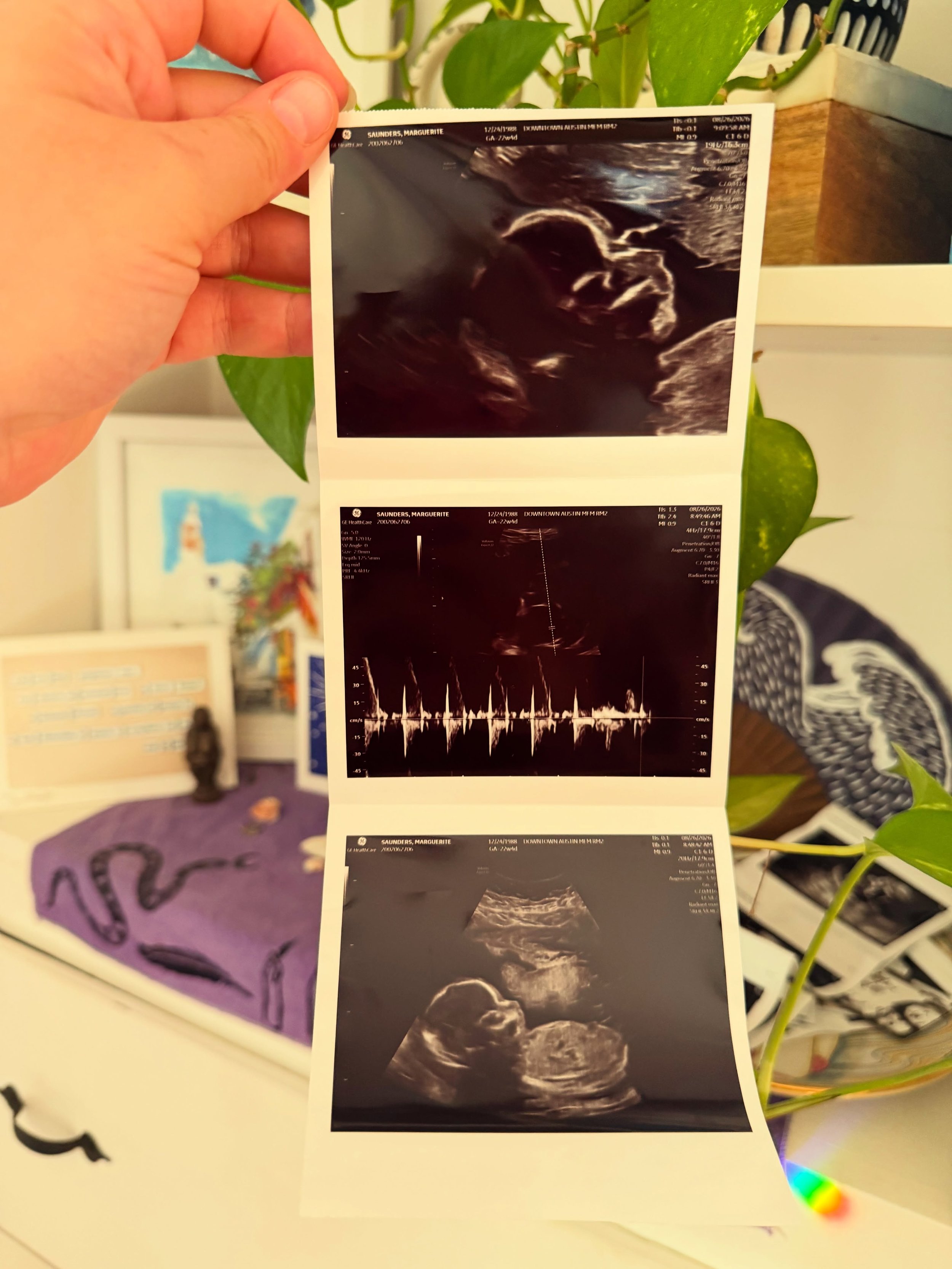 Having a baby with my favorite person 🎉 Coming end of 2026!

Hi, Dad! 🐣

Find out you&rsquo;re pregnant -> immediately go on a prebooked 5 week trip to NYC -> sleep any &amp; every where. ☁️

Baby&rsquo;s first Central Park walk 🌳🏙️☂️

I ha