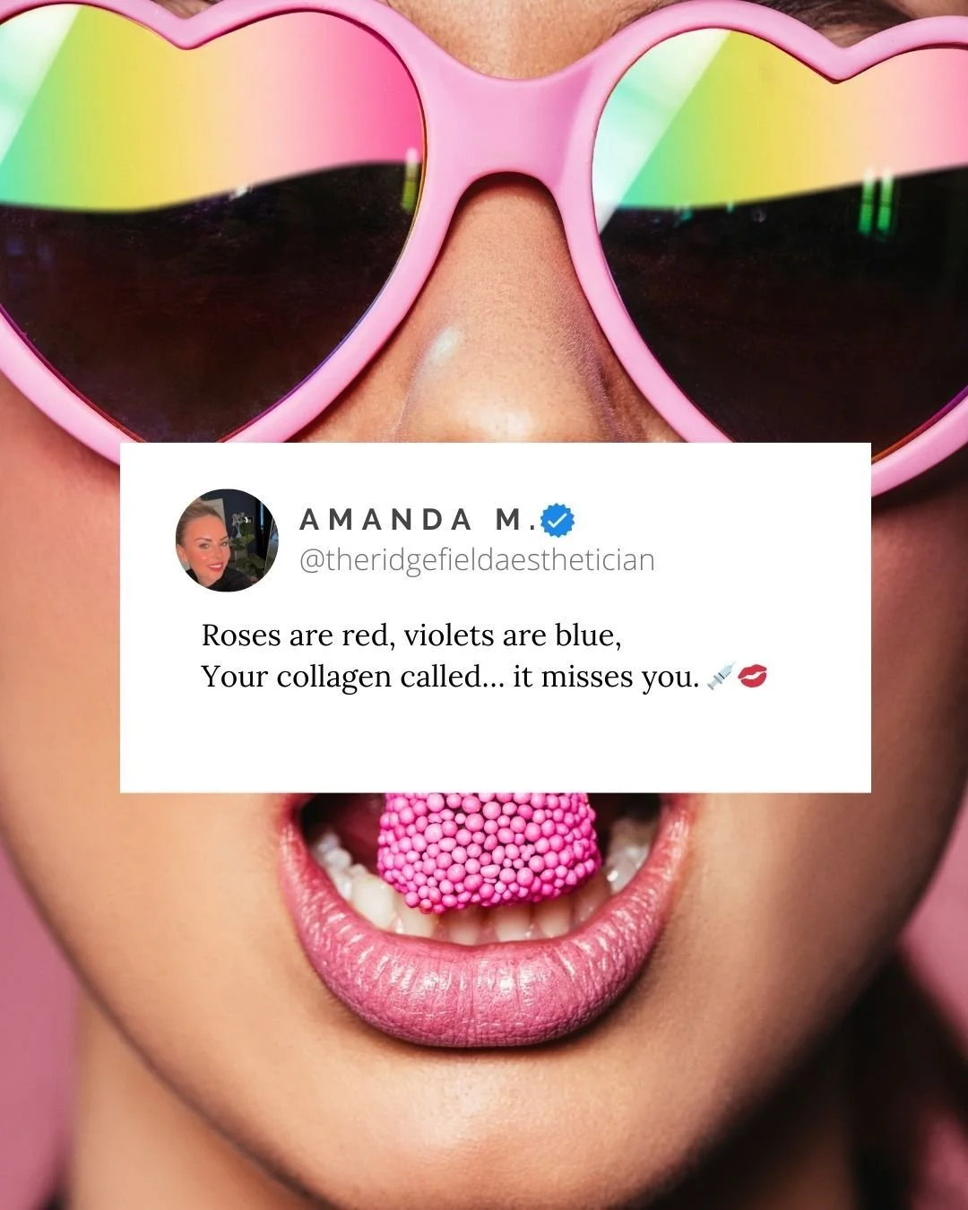 💜💛🩷 Collagen production begins to decline by approximately 1% per year starting in our mid-20s.

As this structural protein decreases, skin gradually loses firmness, elasticity, and resilience &mdash; contributing to fine lines, laxity, and change