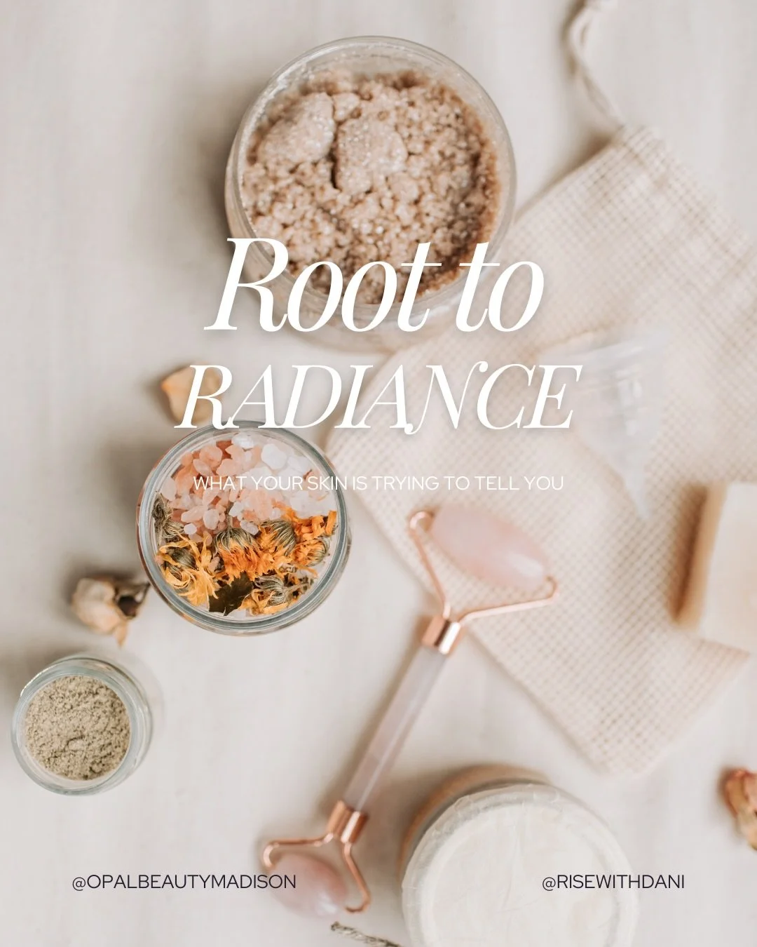 Acne on the cheeks is often a gut + blood sugar signal, not just a skin issue.

When digestion is inflamed or blood sugar is constantly spiking, it can show up as congestion, redness, and breakouts along the cheeks. Supporting the gut lining with bal