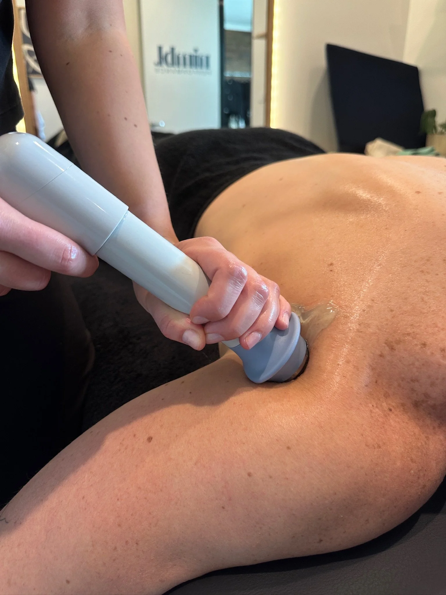 Shockwave therapy for Rotator cuff tendon