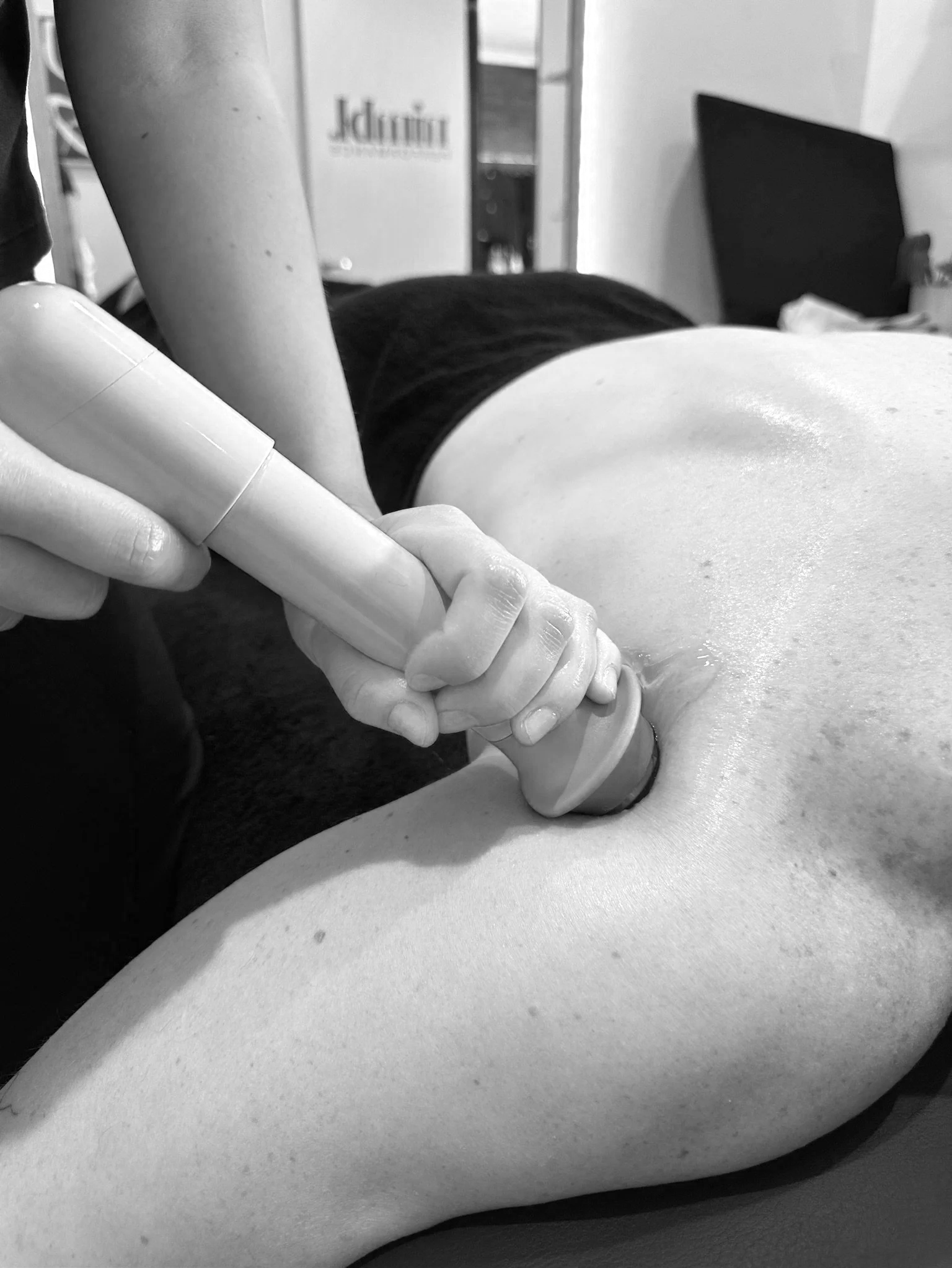 Shockwave therapy