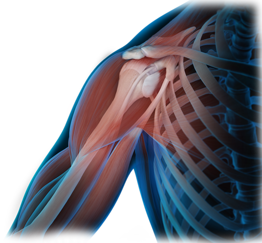 Shoulder surgical illustration