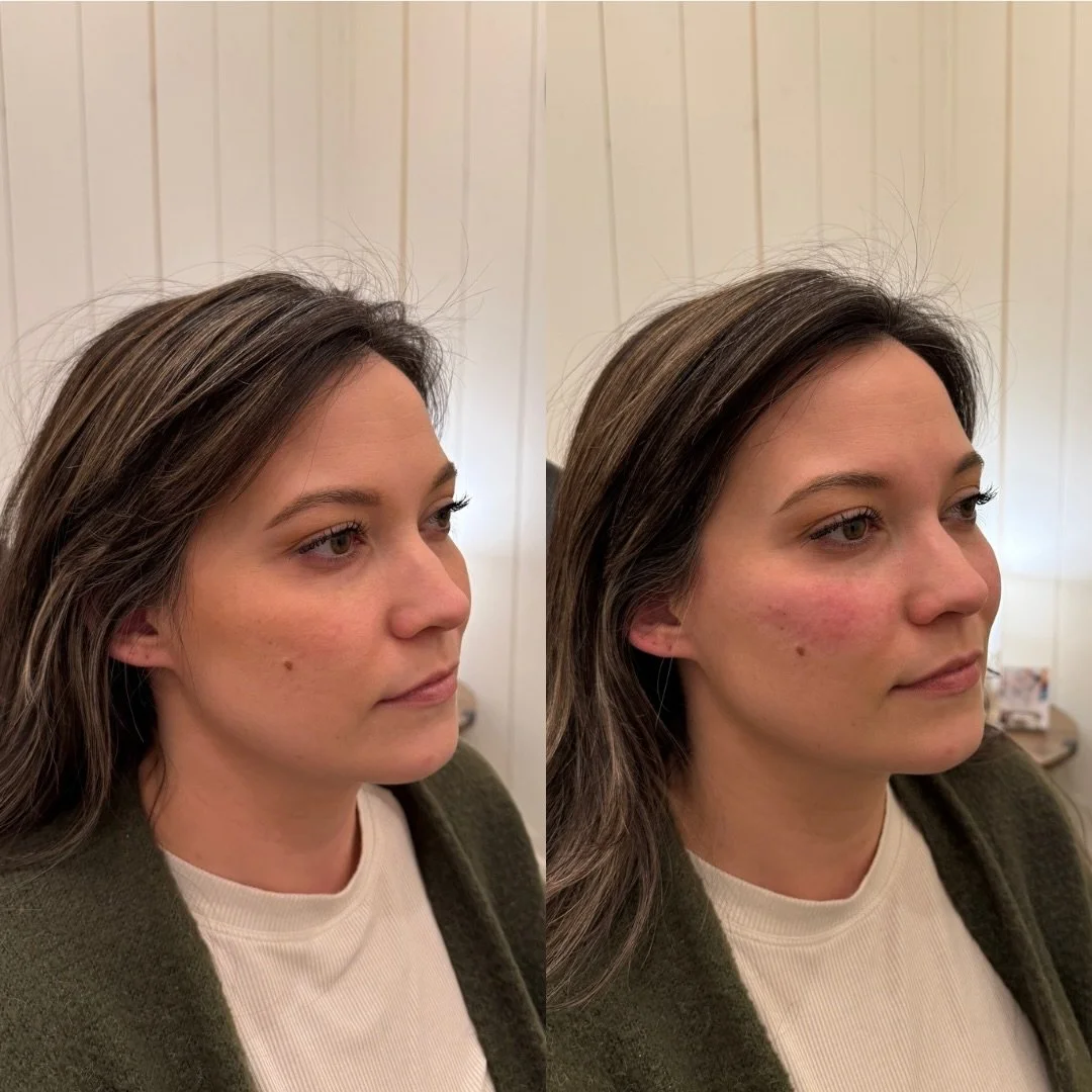 We&rsquo;re so used to seeing dramatic before + afters on social media - the kind where the change is immediately obvious.

But some of the most impactful work is 𝐪𝐮𝐢𝐞𝐭.
The kind you can&rsquo;t quite put your finger on.

This transformation foc