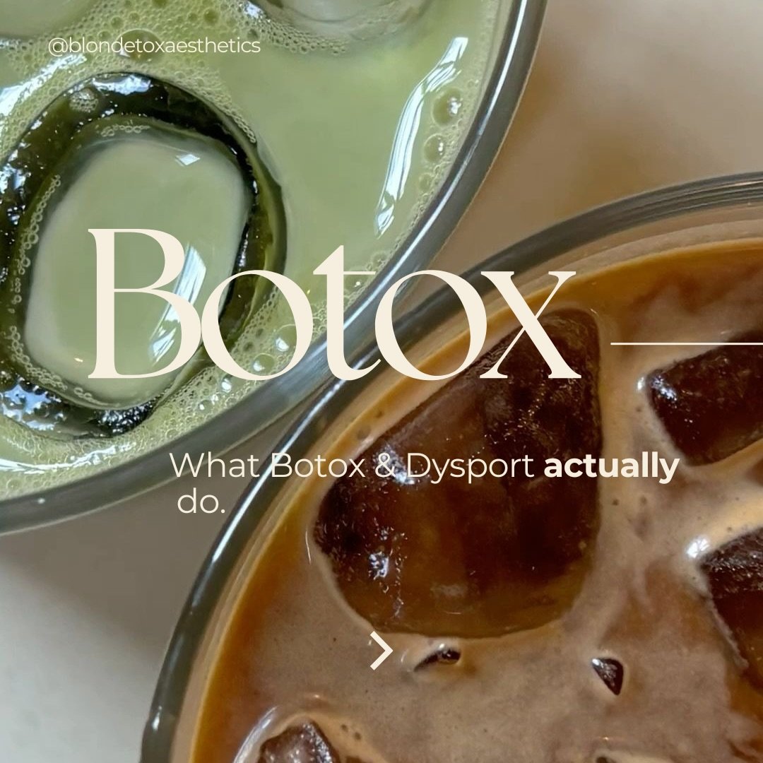 Botox &amp; Dysport don&rsquo;t fill lines. 
They soften the muscle movement that forms them.

Over time, repetitive expression can leave lines lingering at rest. Softening that movement gives the skin space to smooth.

When dosed thoughtfully, the r