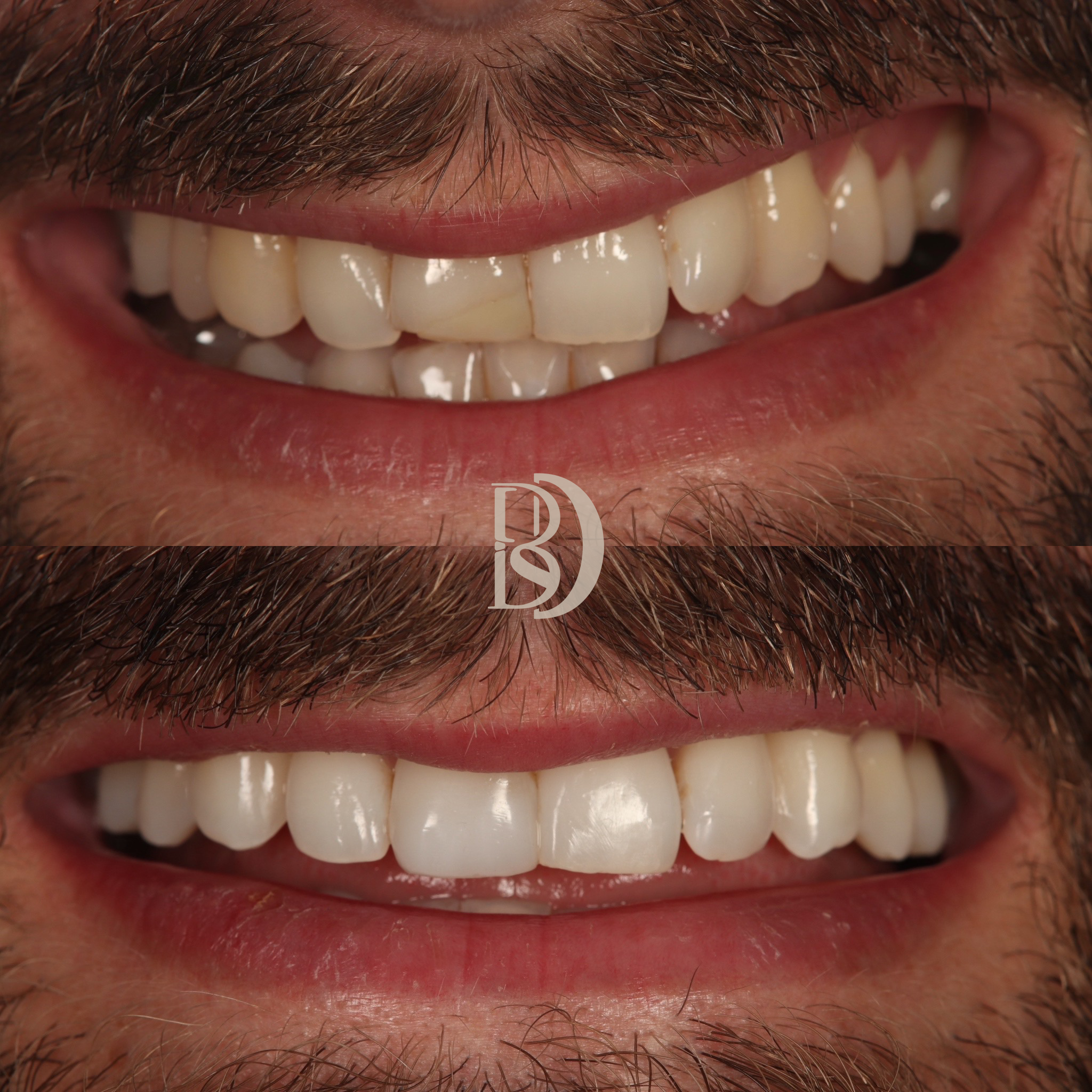 GD ortho composite.png